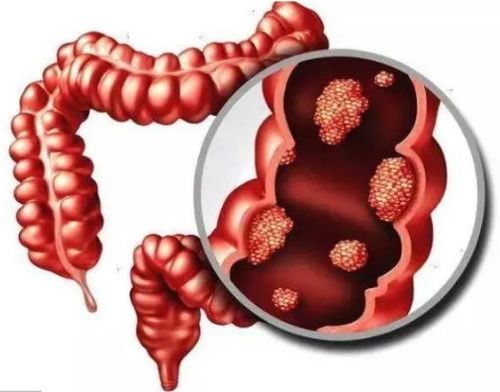 �ѳ������ǲ���������