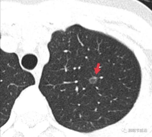 沐浴露已买_沐浴露用完了怎么办 沐浴露已买_沐浴露用完了怎么办