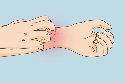下颌骨肿瘤有什么症状 下颌骨肿瘤有什么症状