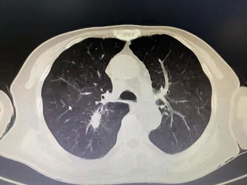 忠犬流浪记 忠犬流浪记叮当最后死了没 忠犬流浪记 忠犬流浪记叮当最后死了没