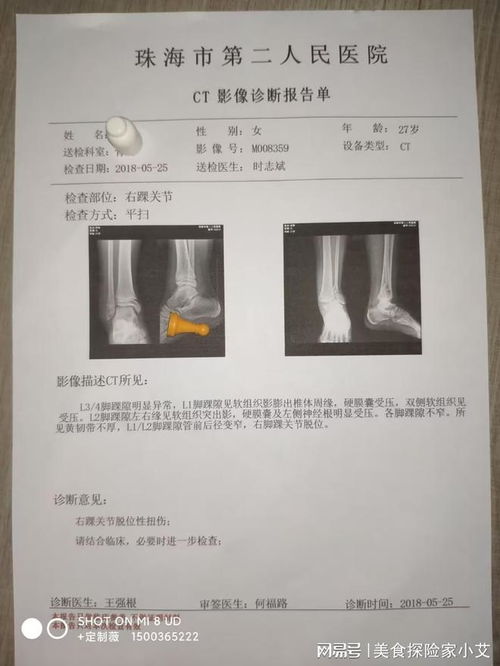 免疫治疗肿瘤费用大吗 免疫治疗肿瘤费用大吗