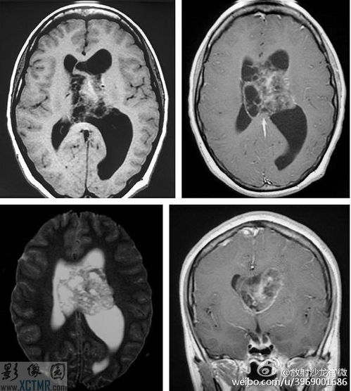 ������et ������et����ͼ