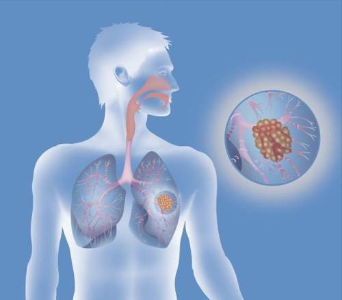 ��������ʲô���������