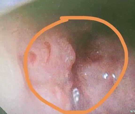 ���������ܳ�������