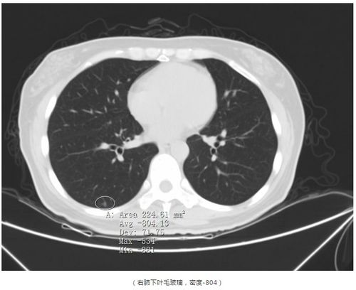 ���������ƺ�ı���ʲô