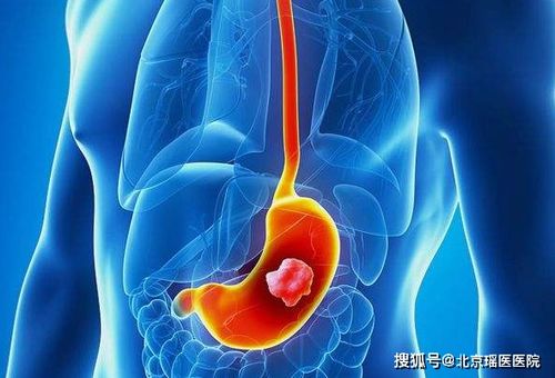 肿瘤后背疼是什么疼法 肿瘤后背疼是什么疼法