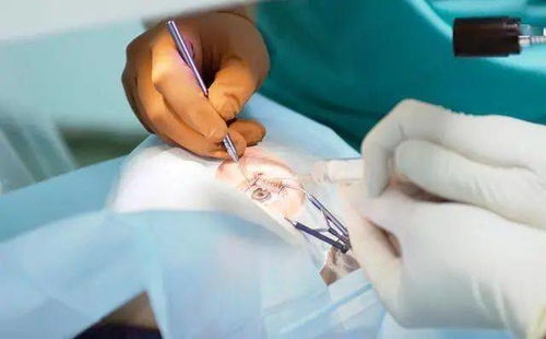 肝脏肿瘤抽烟能活多久啊 肝脏肿瘤抽烟能活多久啊