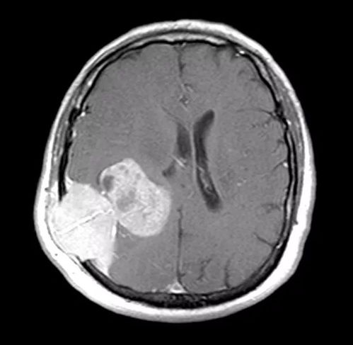 ���յ�С���� ���յ�С�����ʵı�������