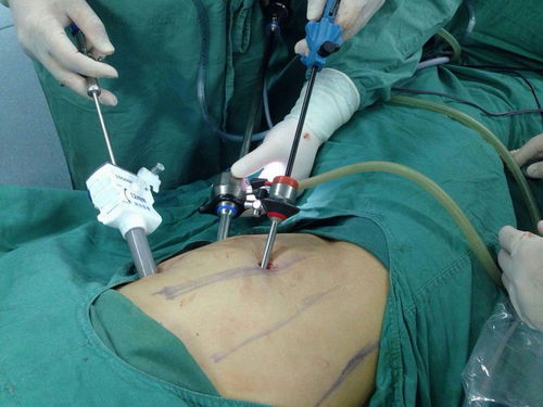 大张伟年龄和个人资料 大张伟年龄和个人资料