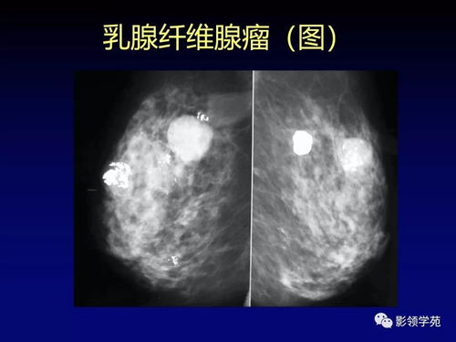 ��׵����ѹ���� ��׵����ѹ�����������մ���