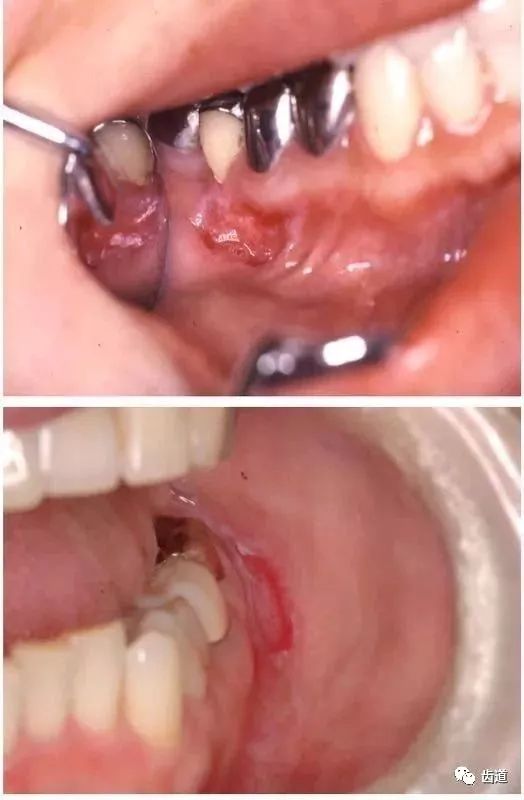 �������費��ҪסԺ����