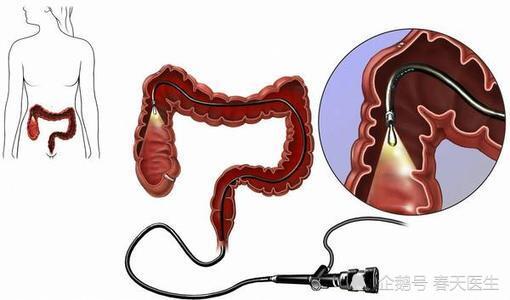 ��������ϸ������ô��