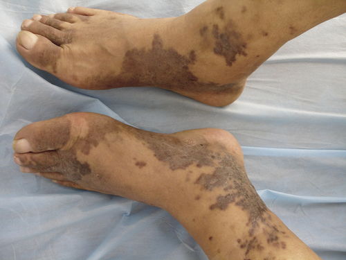 b超能够查出肾脏肿瘤吗 b超能够查出肾脏肿瘤吗