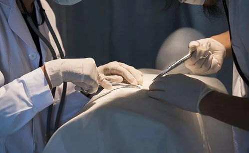 边缘尚规则是恶性肿瘤吗 边缘尚规则是恶性肿瘤吗