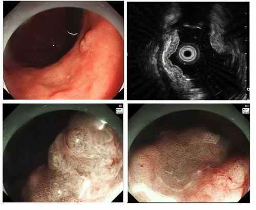 ��������ô���ƲźõĿ�