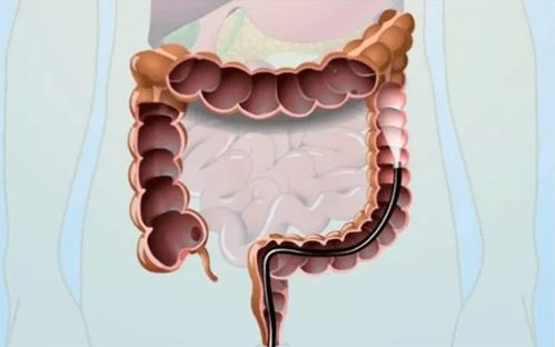 孙桂芝主治几种肿瘤 孙桂芝主治几种肿瘤病理 孙桂芝主治几种肿瘤 孙桂芝主治几种肿瘤病理