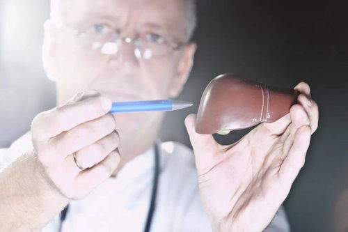 疑似肿瘤会不会没有肿瘤 疑似肿瘤会不会没有肿瘤