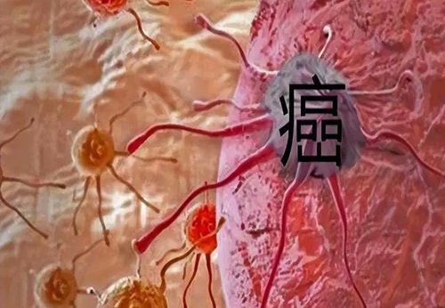 肺部有肿瘤要看什么科 肺部有肿瘤要看什么科