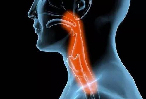 急性心梗是恶性肿瘤吗 急性心梗是恶性肿瘤吗