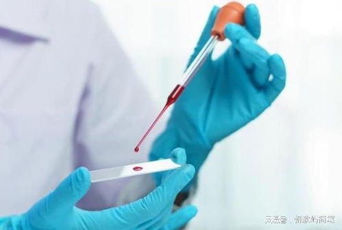 团状物肿瘤是恶性的么 团状物肿瘤是恶性的么