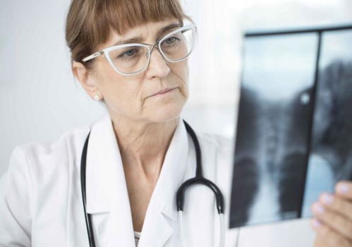 肾肿瘤手术如何做好 肾肿瘤手术治疗方法 肾肿瘤手术如何做好 肾肿瘤手术治疗方法