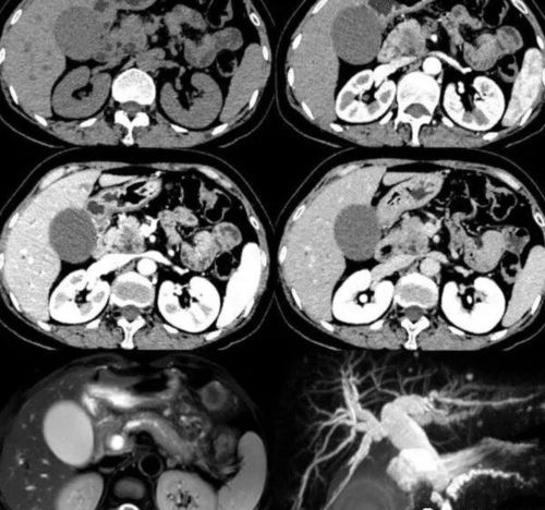 ���������ܲ��ܳ�������