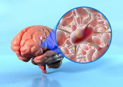 啊纵隔肿瘤其出树_纵隔肿瘤会自己慢慢消失吗 啊纵隔肿瘤其出树_纵隔肿瘤会自己慢慢消失吗