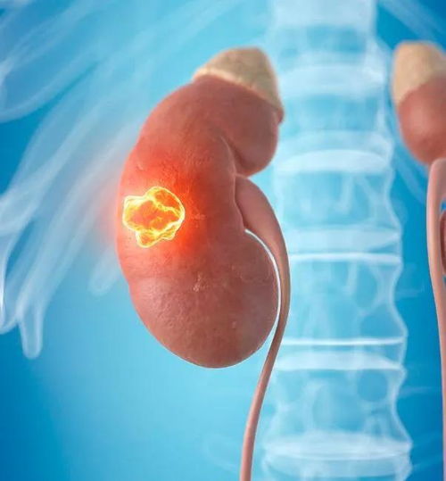 ��������ʲô��˼�� ���������ܻ���