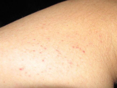 �������ƺ��ò��ܳԷ�