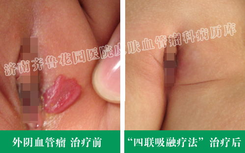 邢台云梦山(邢台云梦山一日游攻略) 邢台云梦山(邢台云梦山一日游攻略)