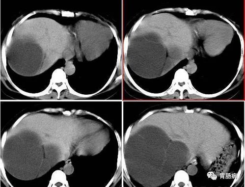 ­���⹵ͨ������Ĥ��