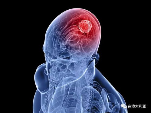 用什么泡脚可以减少肿瘤 用什么泡脚可以减少肿瘤