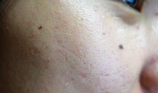 �ܰ���Ѫϵͳ��������