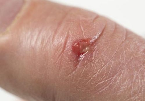 �ζ�������C��_�ζ�������c��ʲô��˼