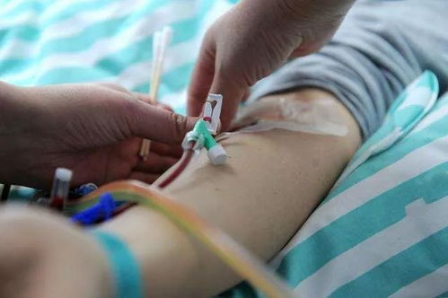 ������Ƥ������ָʲô��