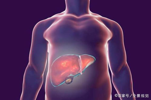 右肩膀肿瘤一般是什么癌 右肩膀肿瘤一般是什么癌