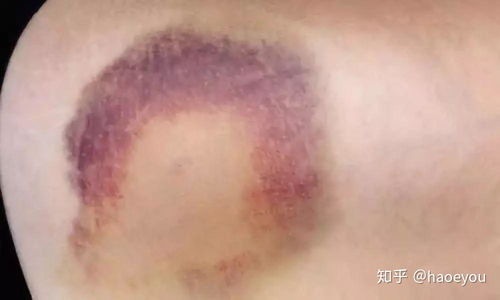 肿瘤内科中级职称考试 肿瘤内科中级职称考试