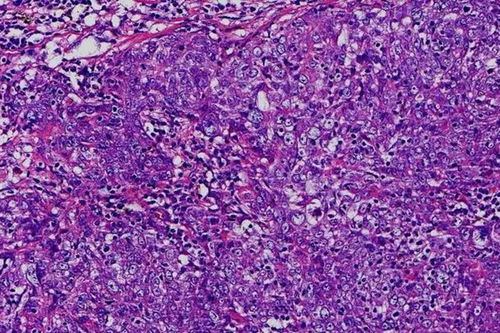 特搜战队刑事连者国语 特搜战队刑事连者国语