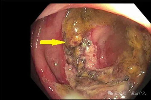 ���������ܳԹ�Բ