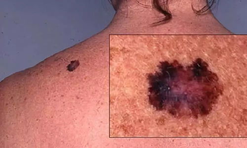 �������������ܱ�����