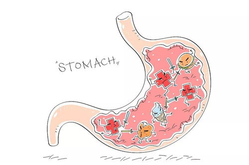 神经源肿瘤有哪些症状 神经源肿瘤有哪些症状