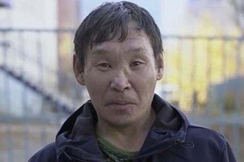 兰山肿瘤医院价格贵吗 兰山肿瘤医院价格贵吗