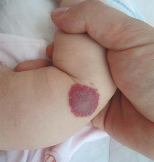 ��������ҽԺ��Ժ����˭