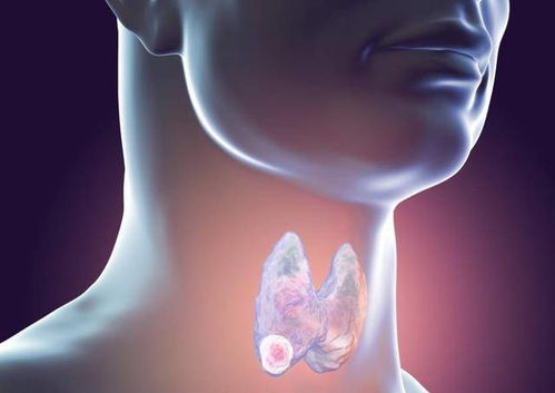 �ż̿Ʋ��� �ż̿Ʋ���2011����ƹ��