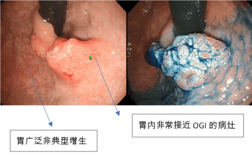 ��������ǰ�ܳ���ҩ��