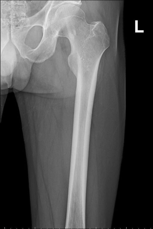 ����־���� ����־˵�Ļ�