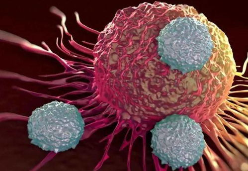 湘雅附一肿瘤科怎么样 湘雅附一肿瘤科怎么样