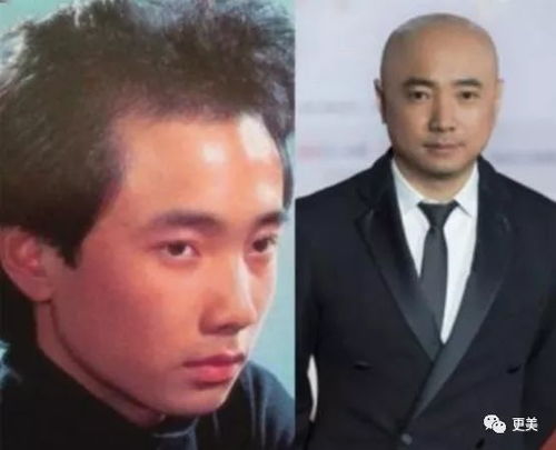 咽喉部恶性肿瘤最常见 咽喉部恶性肿瘤最常见