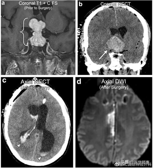天津肿瘤医院肿瘤排名 天津肿瘤医院肿瘤排名