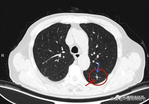 ����������ǻת��֢״